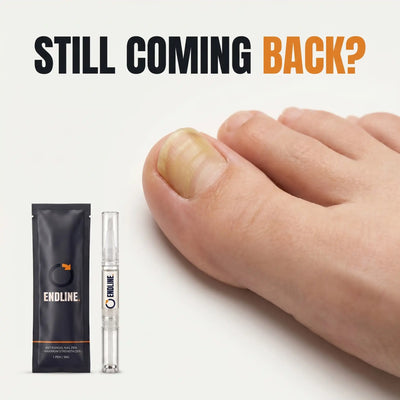 ENDLINE™ - Antifungal Nail· Maximum Strength 25%
