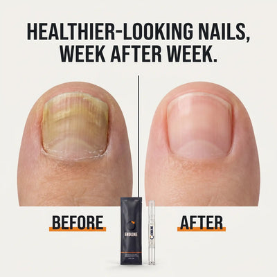 ENDLINE™ - Antifungal Nail· Maximum Strength 25%
