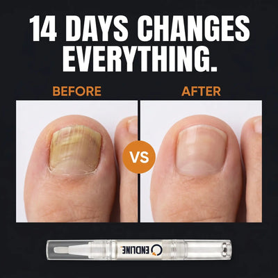 ENDLINE™ - Antifungal Nail· Maximum Strength 25%